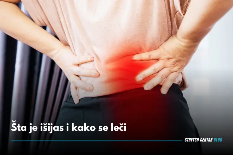 Šta je išijas i kako se leči