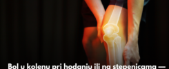 Bol u kolenu pri hodanju ili na stepenicama — kada je normalno, a kada nije