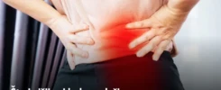 Šta je išijas i kako se leči